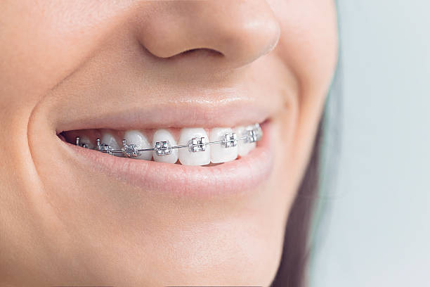 Best Teeth Whitening  in Byram Center, NJ